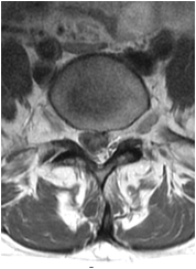 Pre-operative MRI